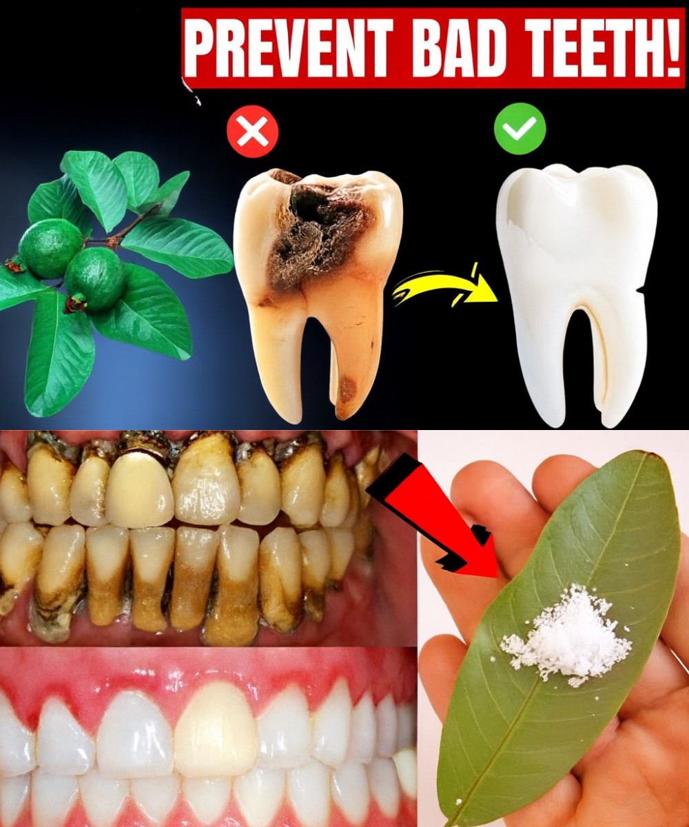 Top 3 Ways to Treat Tooth Decay with Guava Leaves – Simple and Cost-Effective