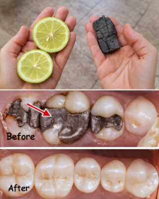 Simple Natural Tips to Support Healthy Teeth – Everyday Habits to Help Maintain Oral Wellness as You Age