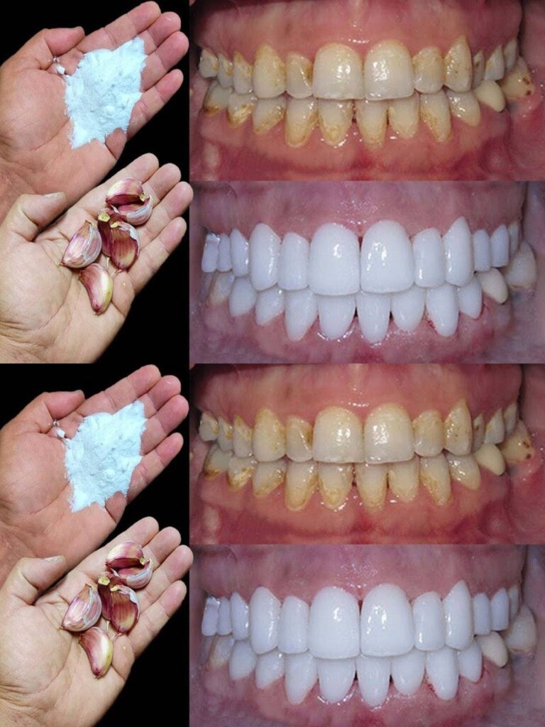 How to whiten your teeth in 2 minutes?