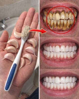 The Fastest Way to Brighten Your Smile at Home: A Simple 3-Minute Baking Soda and Hydrogen Peroxide Paste