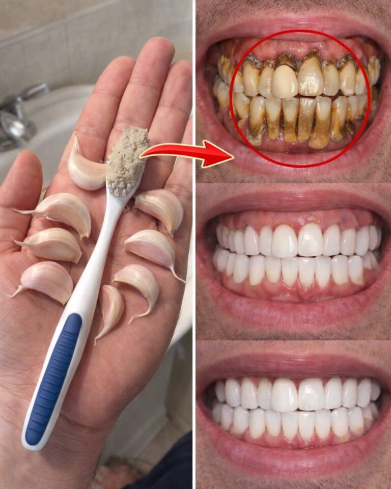 The Fastest Way to Brighten Your Smile at Home: A Simple 3-Minute Baking Soda and Hydrogen Peroxide Paste