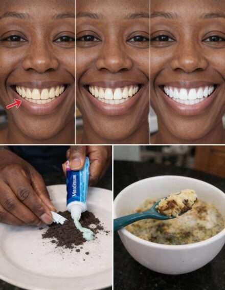 Natural Teeth Whitening at Home: Safe Remedies That May Help Brighten Your Smile