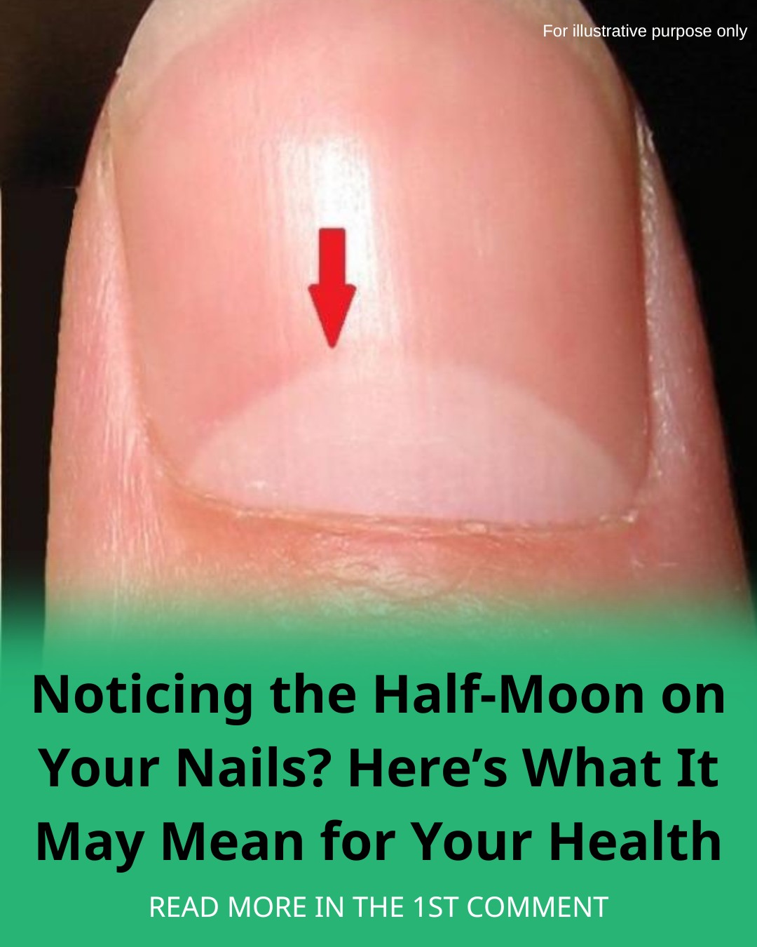 Noticing the Half-Moon on Your Nails? Here’s What It May Mean for Your Health