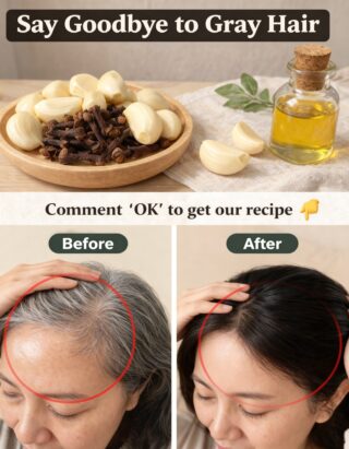 Say Goodbye to Gray Hair with Garlic and Cloves: A Powerful Natural Remedy