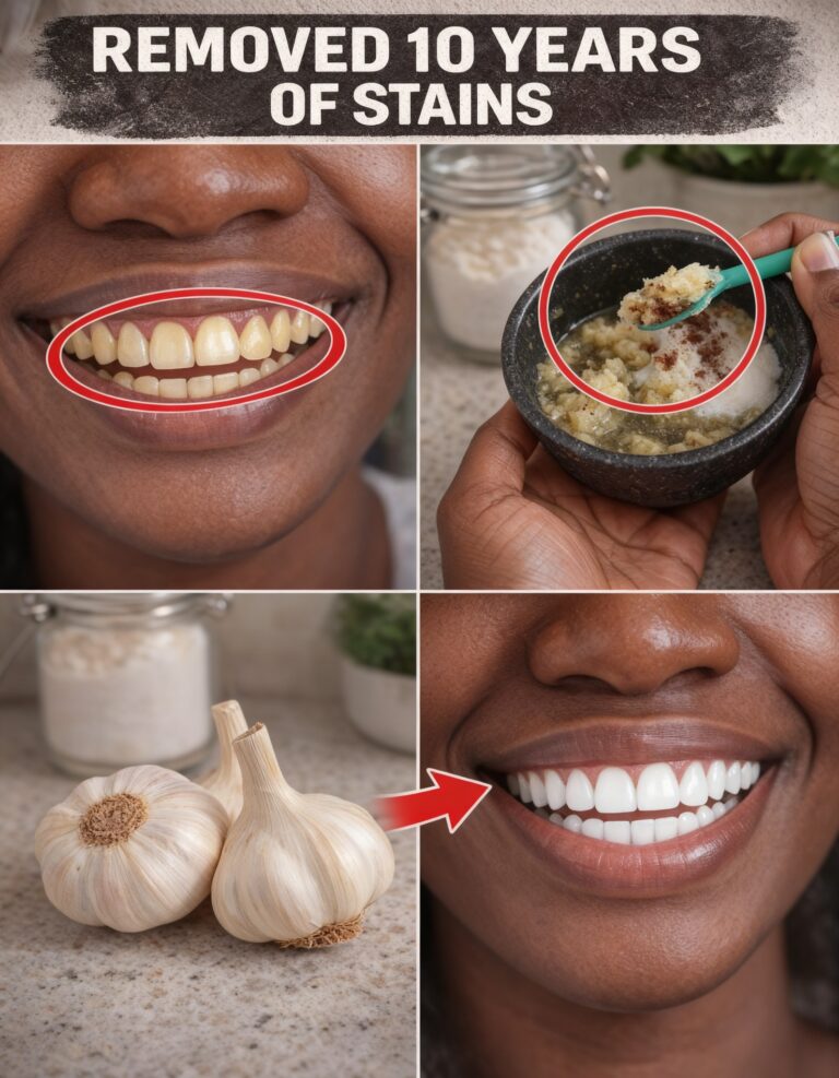 A Natural Way to Brighten Your Smile: The Surprising Garlic Hack You’ve Never Tried