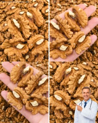 The Surprising Effects of Eating Walnuts Daily, According to Experts