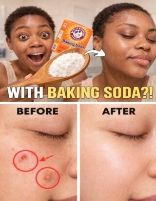 Homemade Baking Soda Cream for Wrinkles and Dark Spots: Is It Worth the Risk?