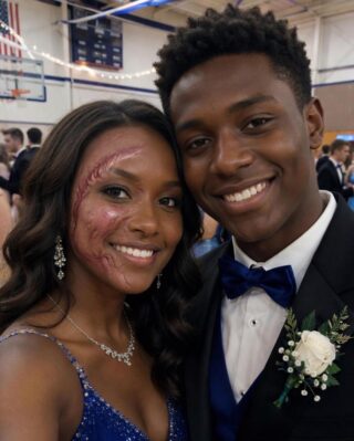 A Boy Asked Me to Dance at Prom Because No One Else Would Due to My Scars – The Next Day, His Parents and Officers Showed up at My Door   PART2