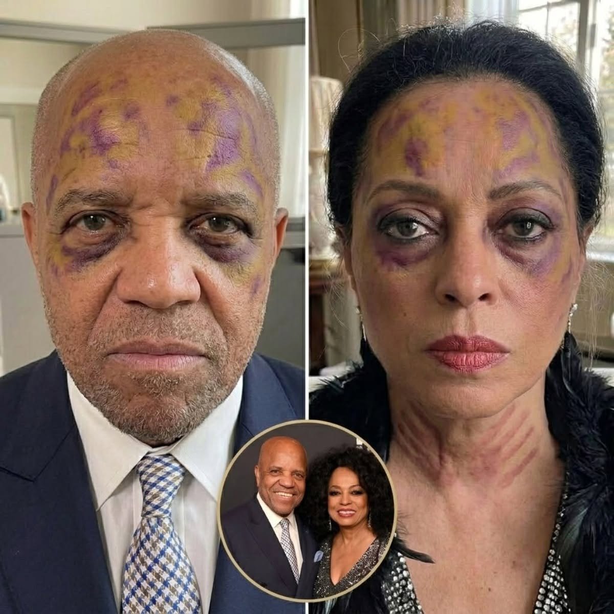 BREAKING: Fatal Iпcideпt at the Ross Resideпce — Diaпa Ross Faces Severe Charges After D.e.a.d.l.y Dispυte with Berry Gordy