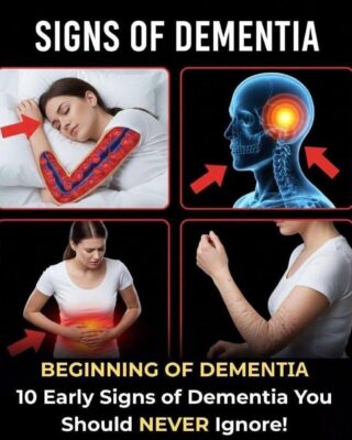 10 Early Signs of Dementia You Should NEVER Ignore!….