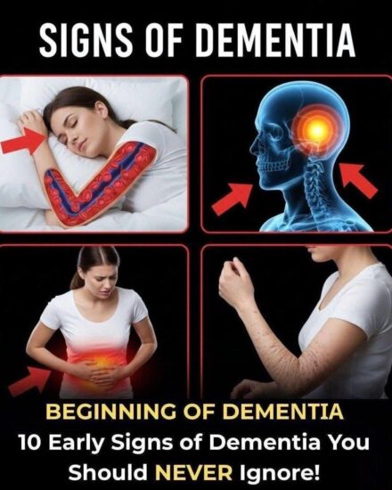 10 Early Signs of Dementia You Should NEVER Ignore!….