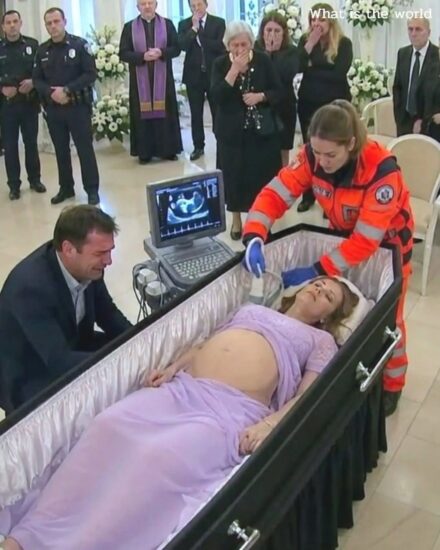 While they were preparing his pregnant wife’s body for cremation, the husband asked to open the coffin one last time 1