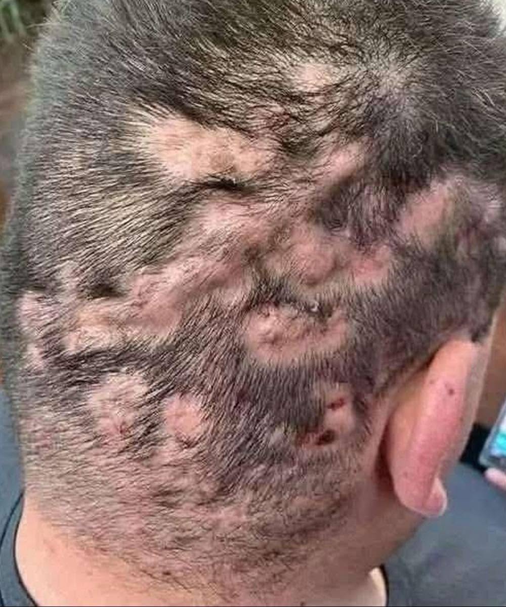 These are the first symptoms