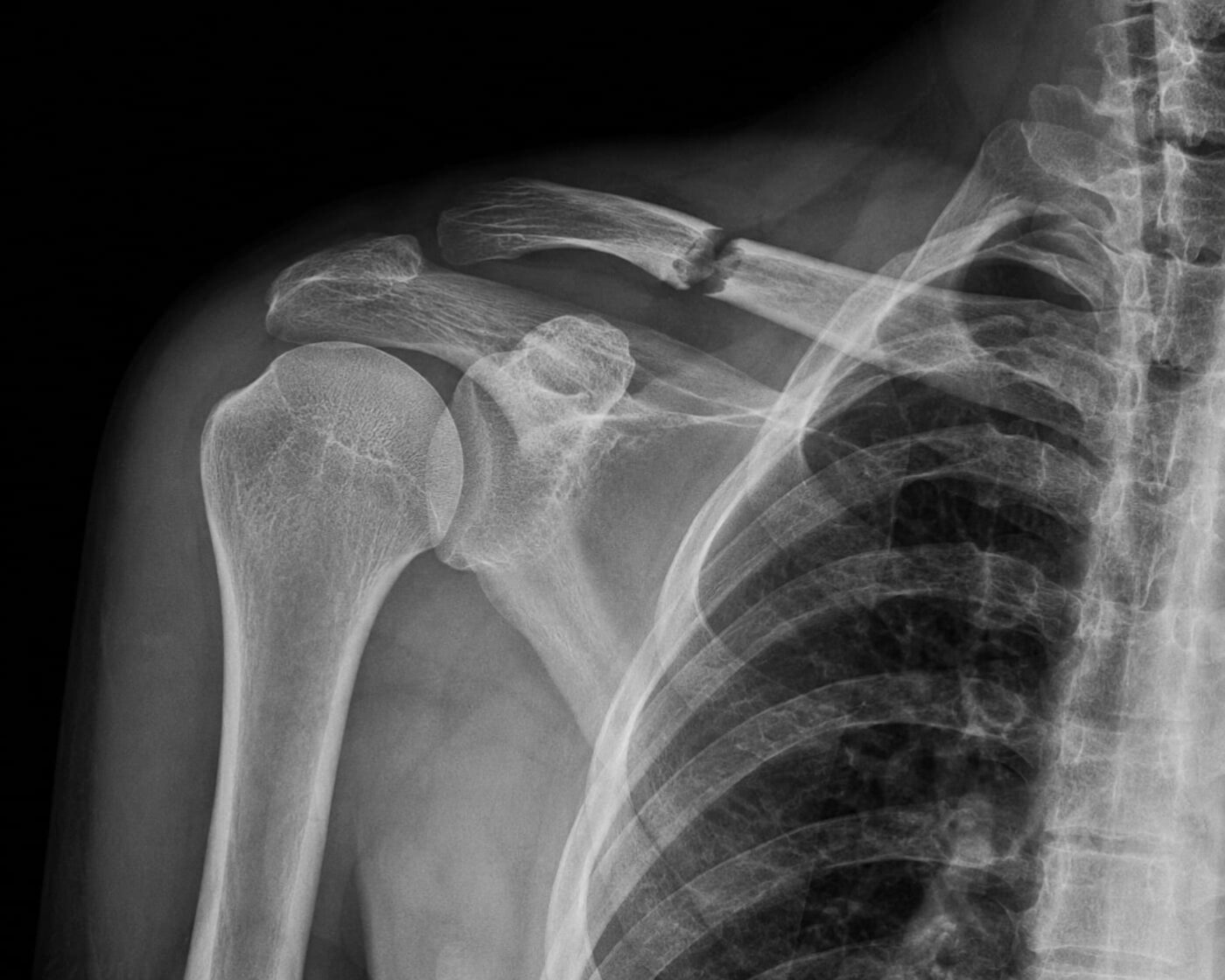 The five drinks that are most harmful to your bones, according to health experts.